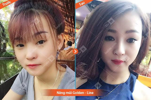 Nguyen-Thi-Tuyet-nang-mui-Golden-Line