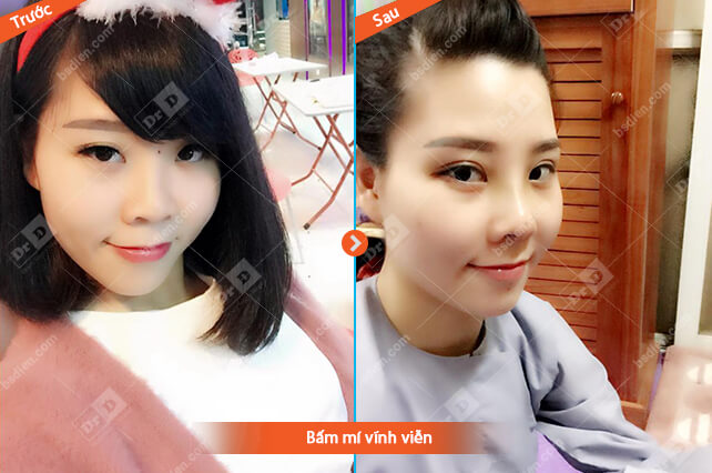 Trang-Nguyen-bam-mi-vinh-vien