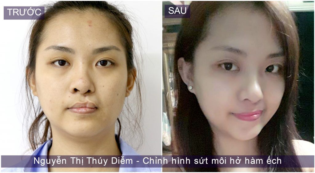 Thuy-diem-1