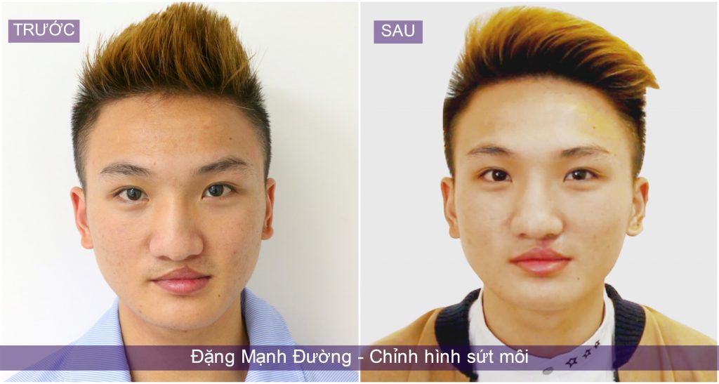 dang-manh-tuong