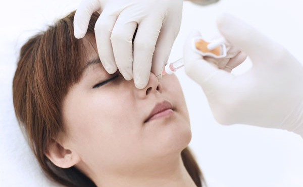 tiêm chất làm đầy filler nâng mũi