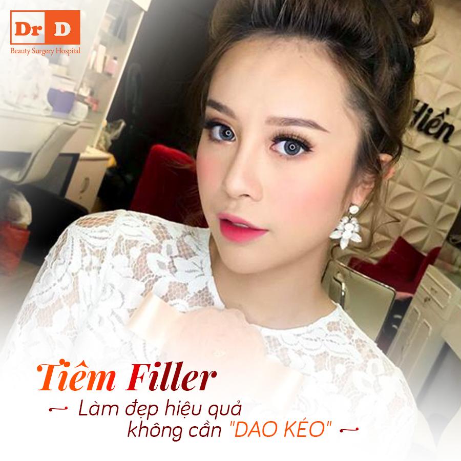 Tiêm filler tạo hình có thể duy trì kết quả từ 1 - 2 năm