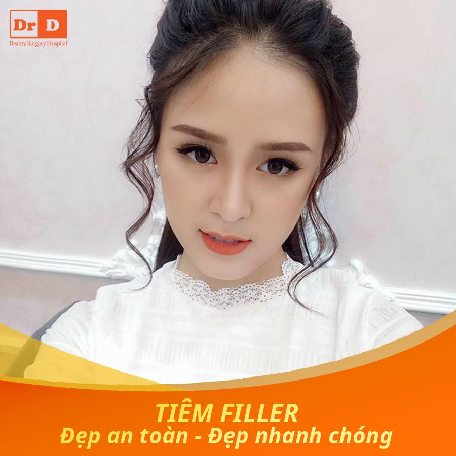 Tiêm Filler tạo hình là bí quyết làm đẹp nhiều chị em theo đuổi