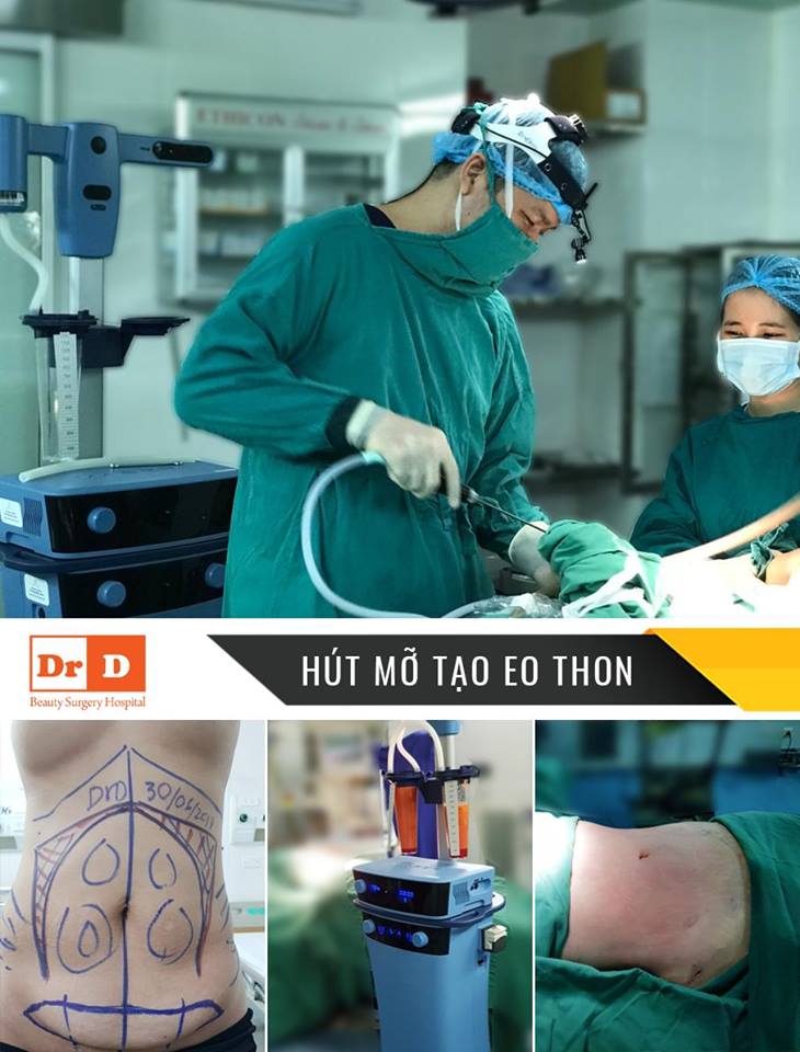 Vaser Lipo loại bỏ mỡ thừa mà không làm tổn thương các vùng lân cận