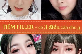 Cần chọn địa chỉ uy tín để tiêm Filler