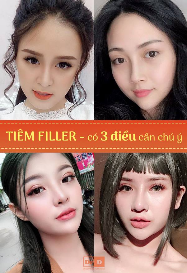 Cần chọn địa chỉ uy tín để tiêm Filler