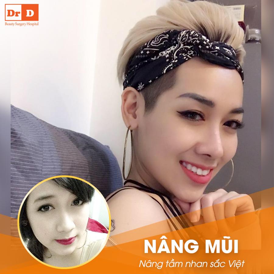 Nâng mũi S Line cao tây, sang chảnh