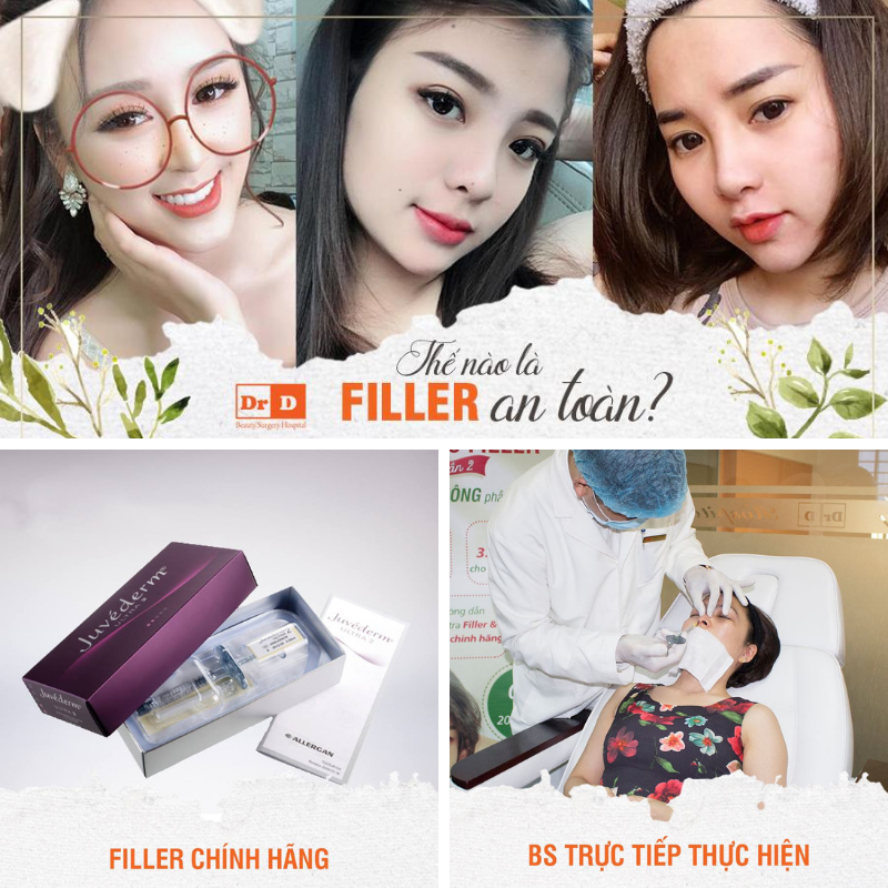 Mọi người vẫn hoài nghi về tiêm chất làm đầy Filler