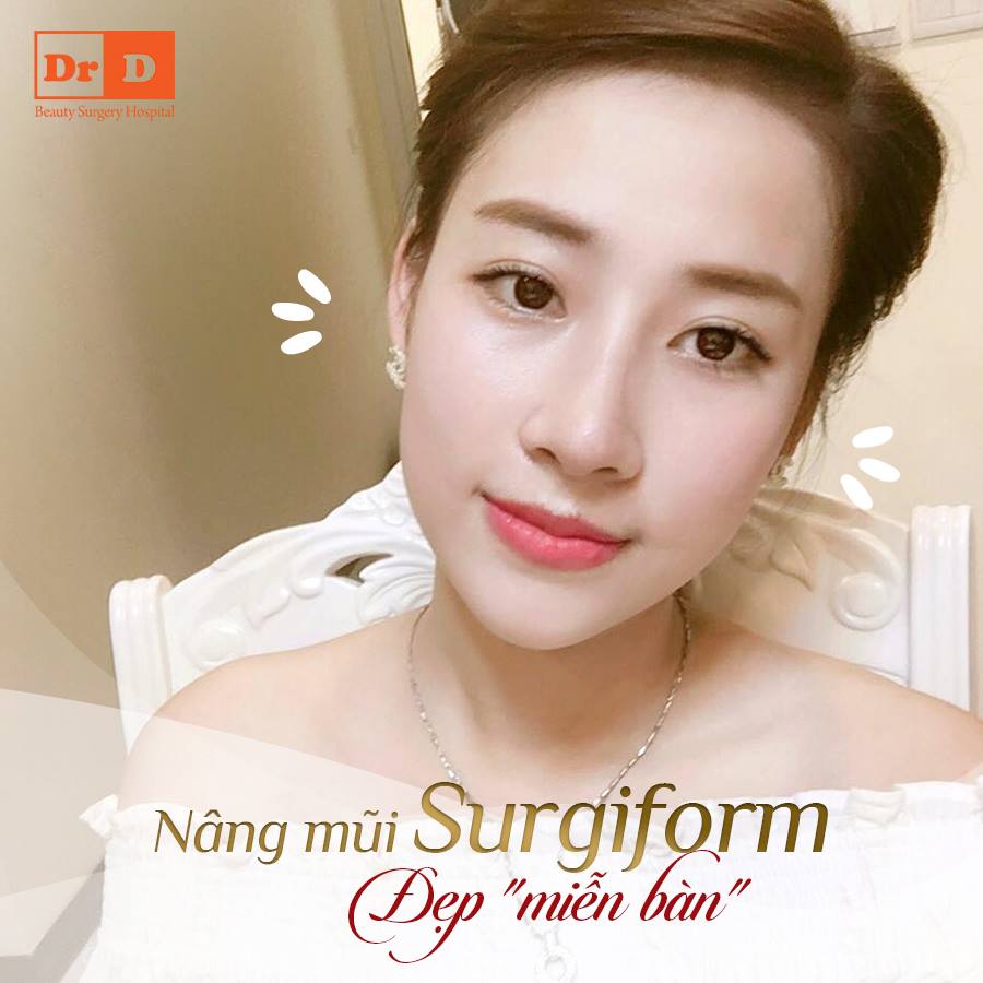 Nâng mũi Surgiform - Đẹp miễn bàn