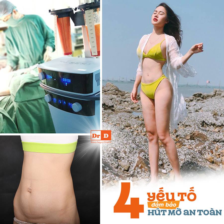 Thẩm mỹ DrD sở hữu công nghệ hút mỡ đỉnh cao Vaser Lipo