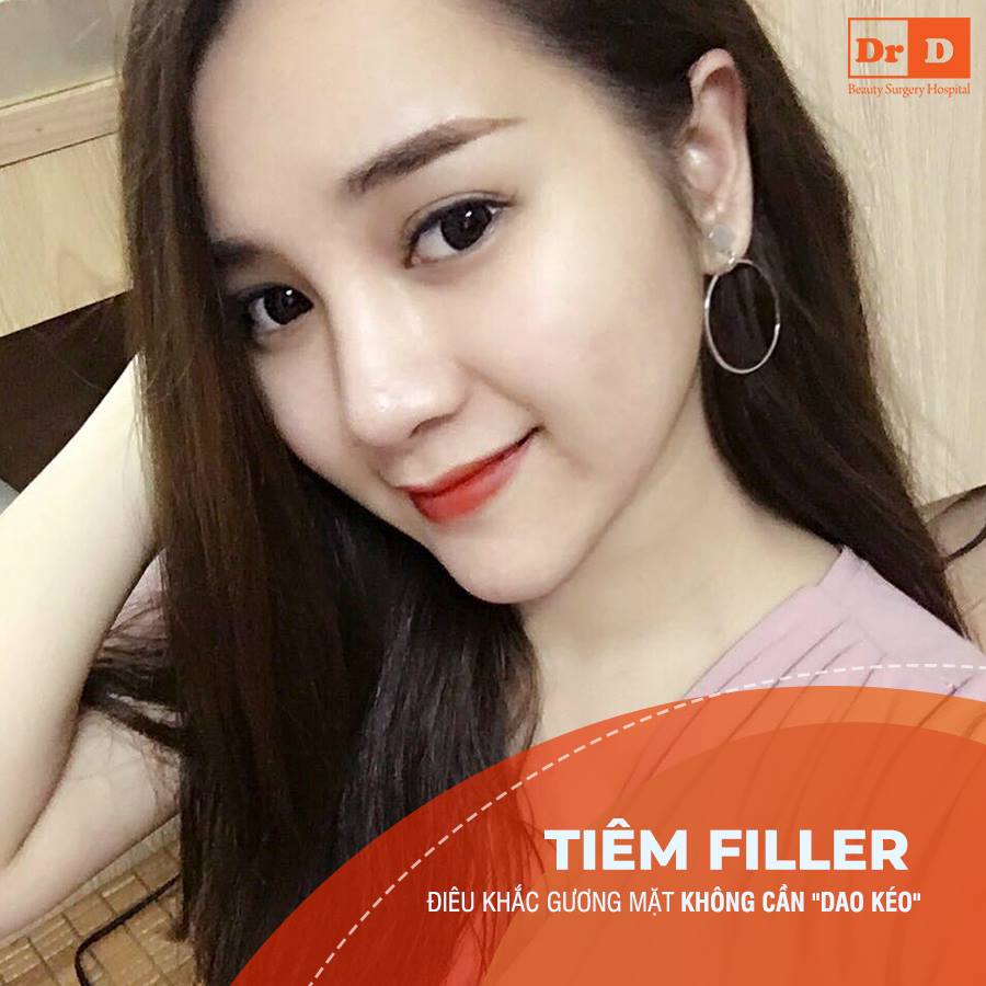 Tiêm Filler tạo hình - Làm đẹp không dao kéo